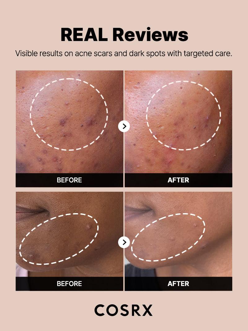 The Alpha-Arbutin 2 Discoloration Care Serum 50ml