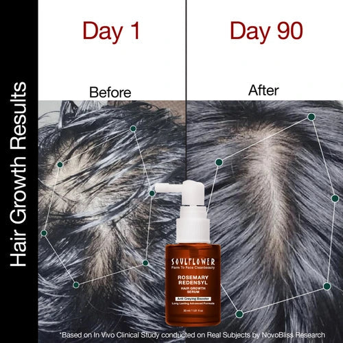 Clinically Proven Rosemary Redensyl Hair Growth Serum with Rosemary 1% Redensyl 3% Anagain 4% and Melanogray 1%